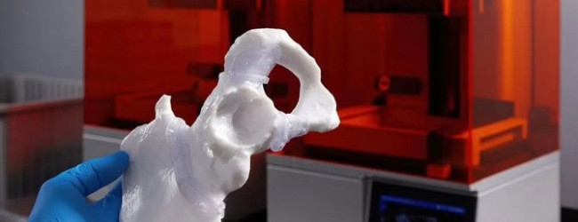 Prototypes and implants
