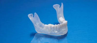 3D printing